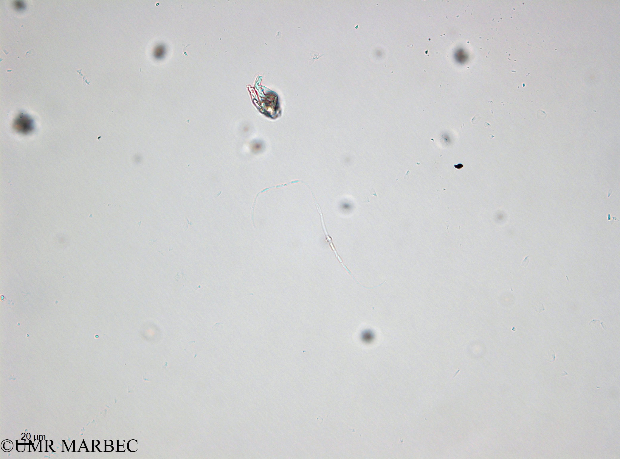 phyto/Bizerte/bizerte_bay/RISCO April 2014/Pseudo-nitzschia delicatissima (- 140729_001_ovl-2)(copy).jpg